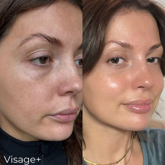 PHYTONUTRIENTS: THE SKINCARE MUST-HAVE FOR 2024